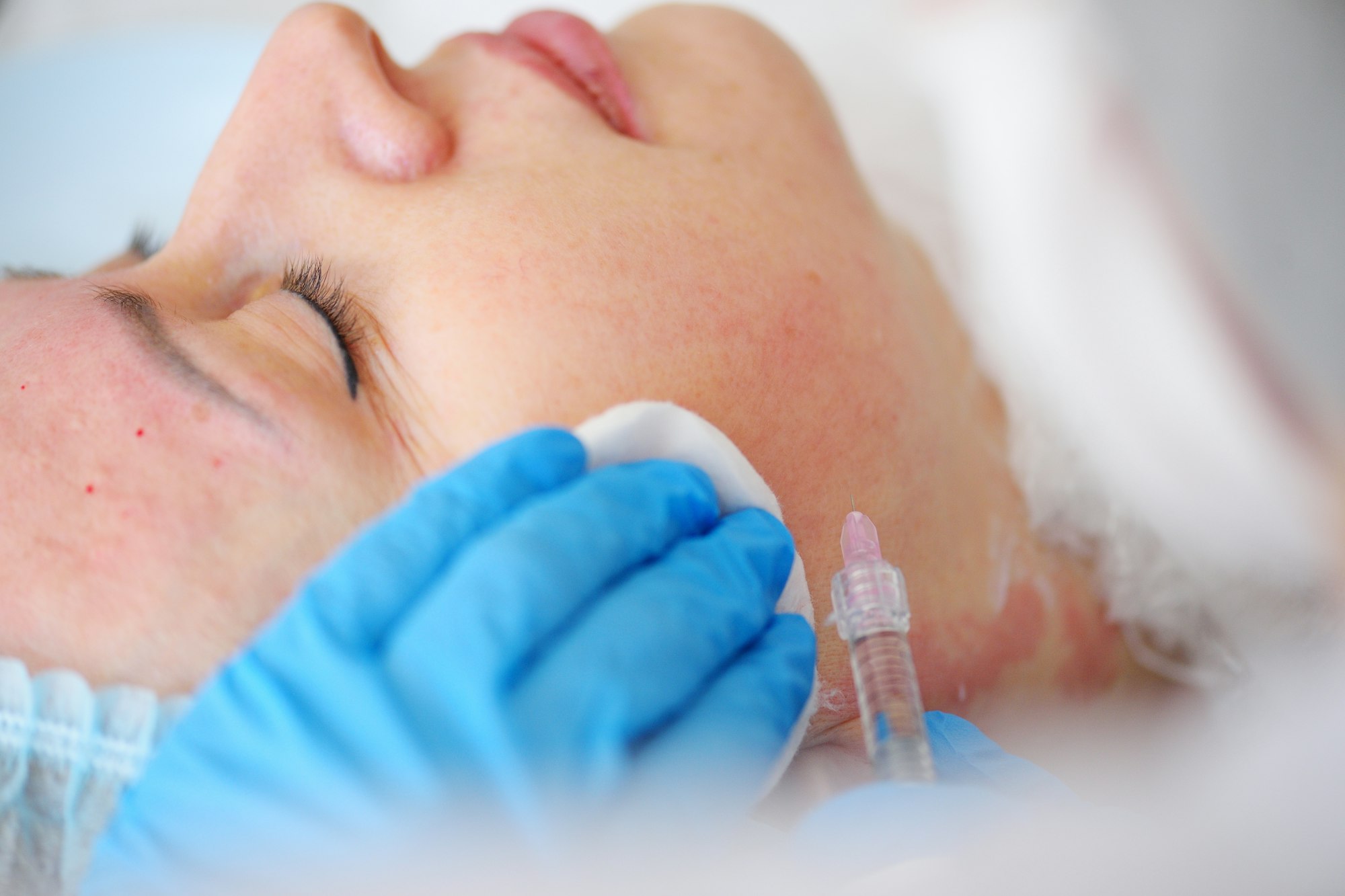 cosmetologist makes a mesotherapy or plasmolifting procedure for the patient. Biorevitalization is a